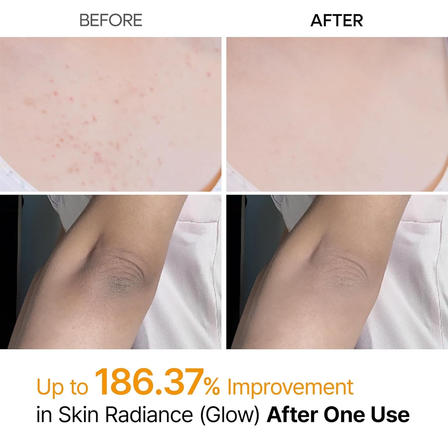 Spray Exfoliante de Ácido Kójico y Cúrcuma