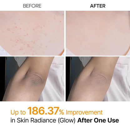 Spray Exfoliante de Ácido Kójico y Cúrcuma